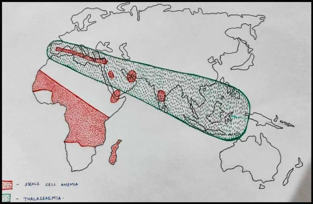 ലോക ഭൂപടം- താലിസീമിയ, സിക്കിൾ സെൽ അനീമിയ എന്നിവയുടെ വിതരണം  / Photo: W H O, Dr Sitalakshmi, St Johns, Bangalore, India 