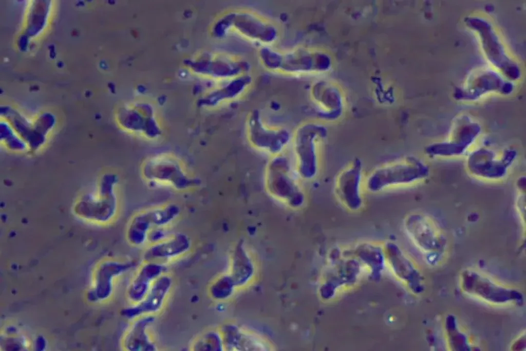 ലോകത്ത് തന്നെ വിരളമായ രോഗമായതിനാൽ അമീബിക് മസ്തിഷ്ക ജ്വരത്തിൻെറ രോഗപകർച്ചയുടെ രീതികൾ ശാസ്ത്രത്തിന് തന്നെ ലഭ്യമായിട്ടില്ല.