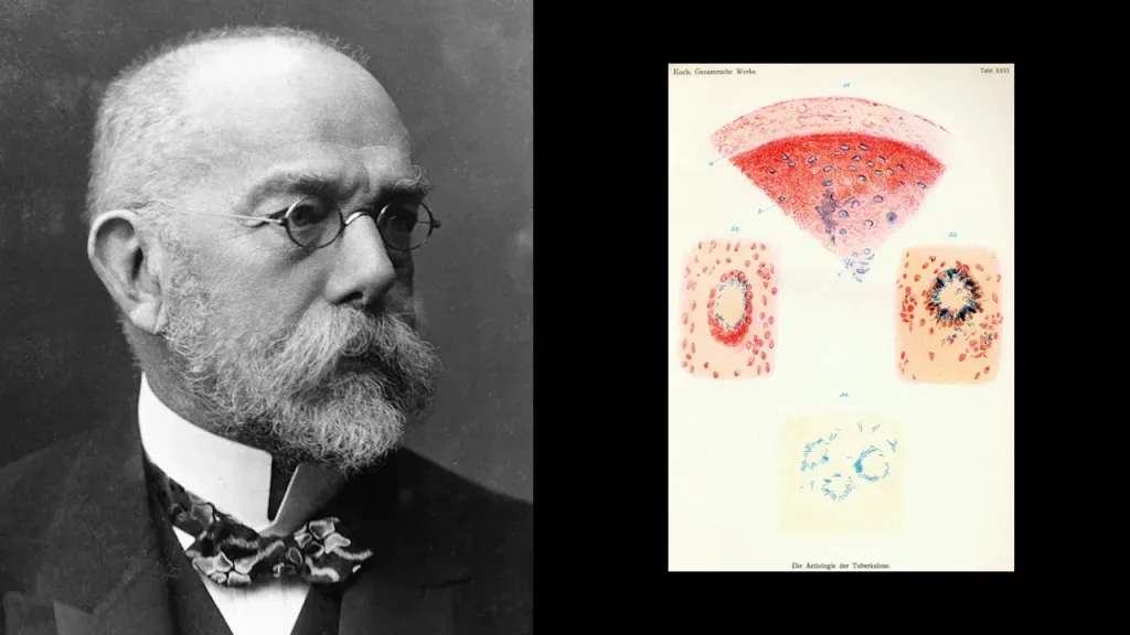 പകർച്ചവ്യാധി ഗവേഷണം തുടർന്ന് കോക്ക് 1876- ൽ ആന്ത്രാക്സിന് കാരണമായ ബാസിലസ് ആന്ത്രാസിസും (Bacillus anthracis)  1882- ൽ ക്ഷയരോഗത്തിന് കാരണമായ മൈക്കോബാക്ടീരിയം ടൂബർക്കുലോസിസും  (Mycobacterium tuberculosis) കണ്ടെത്തി.