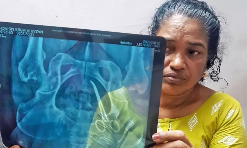 ആലപ്പുഴ മെഡിക്കൽ കോളേജാശുപത്രിയിൽ നടന്ന ശസ്ത്രക്രിയക്കിടെ വയറ്റിൽ ആർട്ടറി ഫോർസെപ്സ് കുടുങ്ങിയ ഉഷ ജോസഫ് എക്സ്റേയുമായി. നൂറു ശതമാനം ശ്രദ്ധയുണ്ടായിരുന്നുവെങ്കിൽ, പ്രോട്ടോക്കോൾ കൃത്യമായി പാലിച്ചിരുന്നുവെങ്കിൽ ഈ ചികിത്സാപ്പിഴവ് സംഭവിക്കുമായിരുന്നില്ല. 