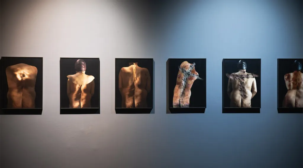 മൂന്നു സർജറിക്ക് വിധേയമാക്കിയ തന്റെ നട്ടെല്ല് ഉൾക്കൊള്ളുന്ന പുറംഭാഗത്തിന്റെ ദുരവസ്ഥകളെയും, അതിന്റെ വേദനയെയും ആഘോഷിക്കുന്ന ഫോട്ടോഗ്രാഫിക് ഇൻസ്റ്റലേഷനാണ്  ഈ പ്രദർശനത്തിന്റെ മുഖ്യഭാഗം. 