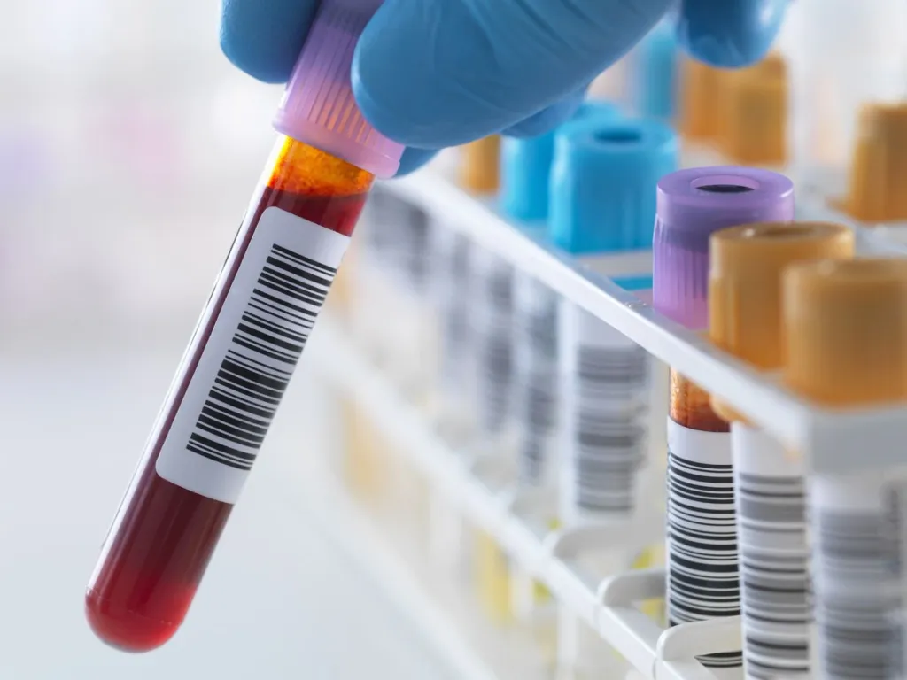 NAT (Nucleic Acid Testing)  - വൈറസുകളുടെ സാന്നിധ്യം വളരെ നേരത്തെ കണ്ടെത്താൻ സഹായിക്കുന്ന രീതി