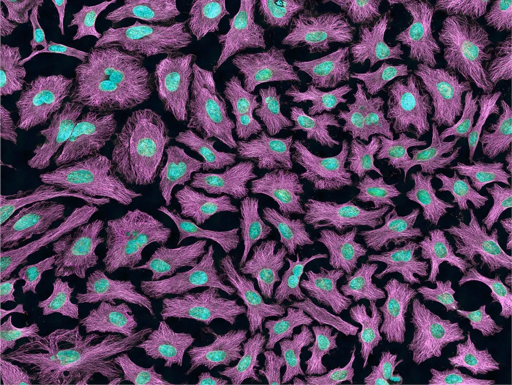 HeLa cells